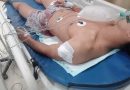 Diduga Geng Motor Tusuk Karyawan Pabrik Saat Pulang Kerja di Batam Centre